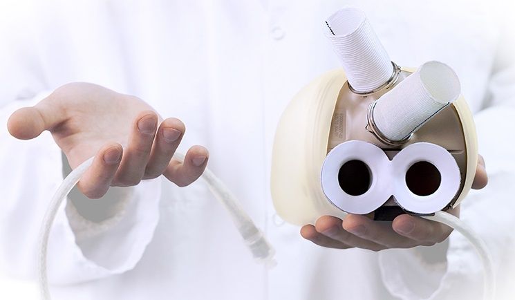 CENTRE Yaoundé Transplantation cardiaque